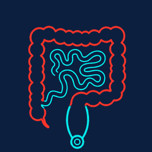 Crohn's colitis with a relatively spared rectum