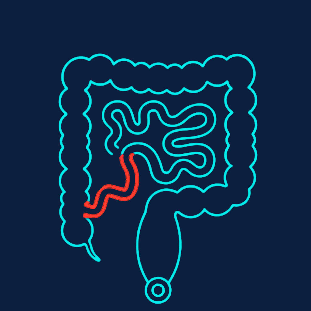 Before: terminal ileitis — the inflamed last part of the small intestine